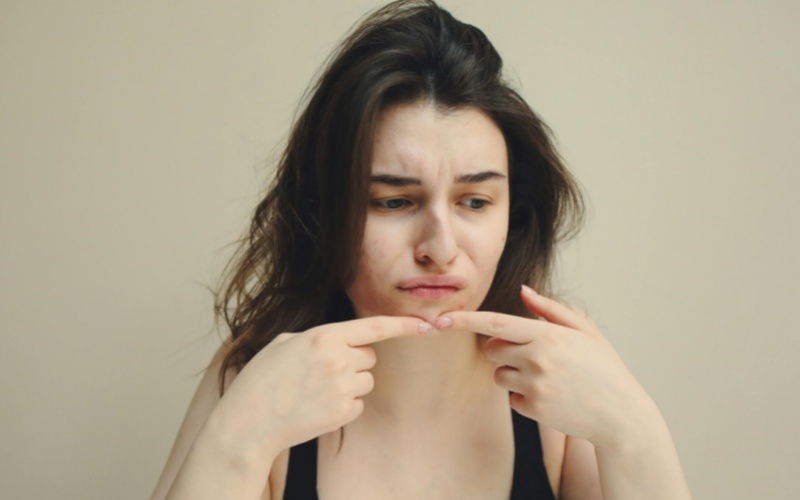 【莱沃医疗：知识分享】关于痘印修复，90%的人都做错了